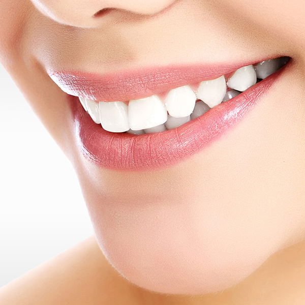 Is teeth whitening safe scaled